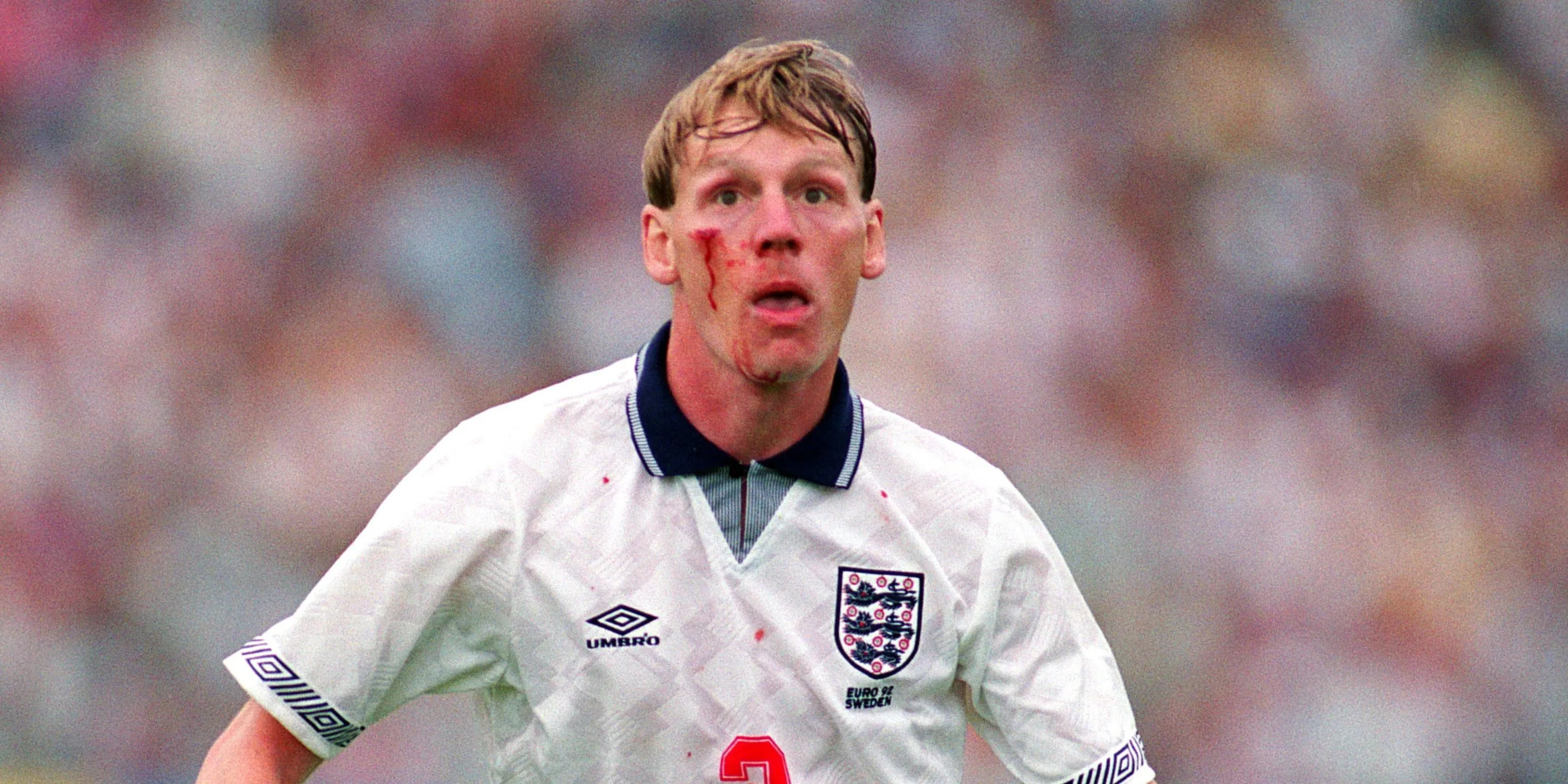Stuart Pearce với vết thương trên đầu, hình ảnh biểu tượng về sự dũng cảm